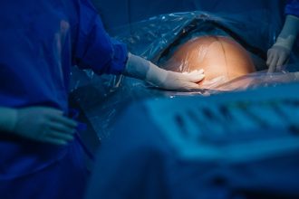 turcia interzice nasterile prin cezariana in clinici private regimul erdogan vorbeste despre nevoia de crestere a natalitatii 6807b3a4c0aba