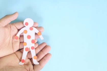 focar de rujeola in israel numarul cazurilor a ajuns la 48 majoritatea fiind copii nevaccinati 682611e0123c5