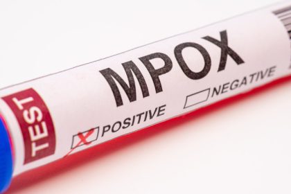 macedonia de nord a raportat primele sale doua cazuri de infectare cu mpox apelul autoritatilor catre cetateni 683091023ad87