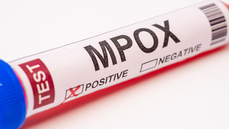 macedonia de nord a raportat primele sale doua cazuri de infectare cu mpox apelul autoritatilor catre cetateni 683091023ad87