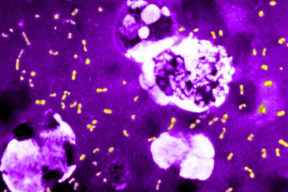 cum a evoluat cea mai letala bacterie din toate timpurile ca sa continue sa omoare milioane de oameni si sa supravietuiasca pana astazi 683e748572e23