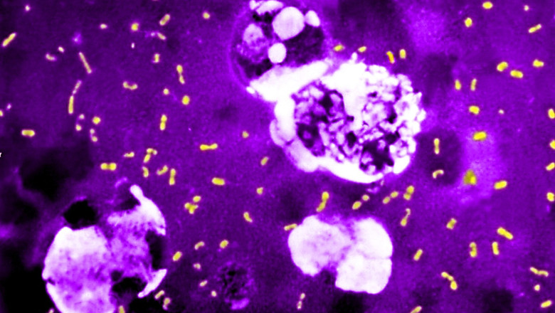 cum a evoluat cea mai letala bacterie din toate timpurile ca sa continue sa omoare milioane de oameni si sa supravietuiasca pana astazi 683e748572e23