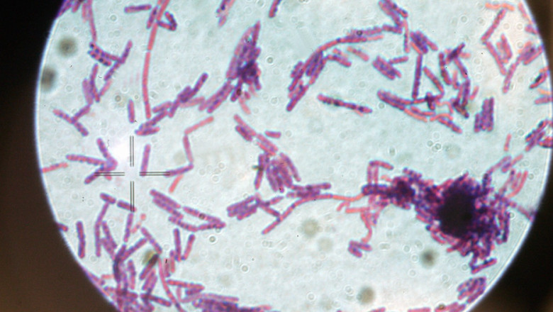 suspiciune de antrax la doua persoane internate la institutul national de boli infectioase matei bals din bucuresti 686e8fc1dbcff