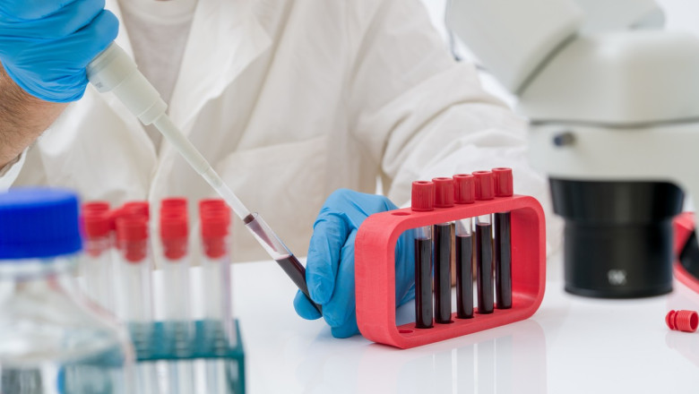 un test de sange ar putea detecta prezenta mutatiilor maligne cu 3 ani inainte de aparitia primelor simptome de cancer arata un studiu 6864b609005b6