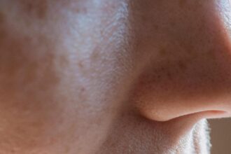 cum sa scapi de punctele negre de pe nas ingredientul din bucatarie care curata tenul 68cc3ca38a6eb