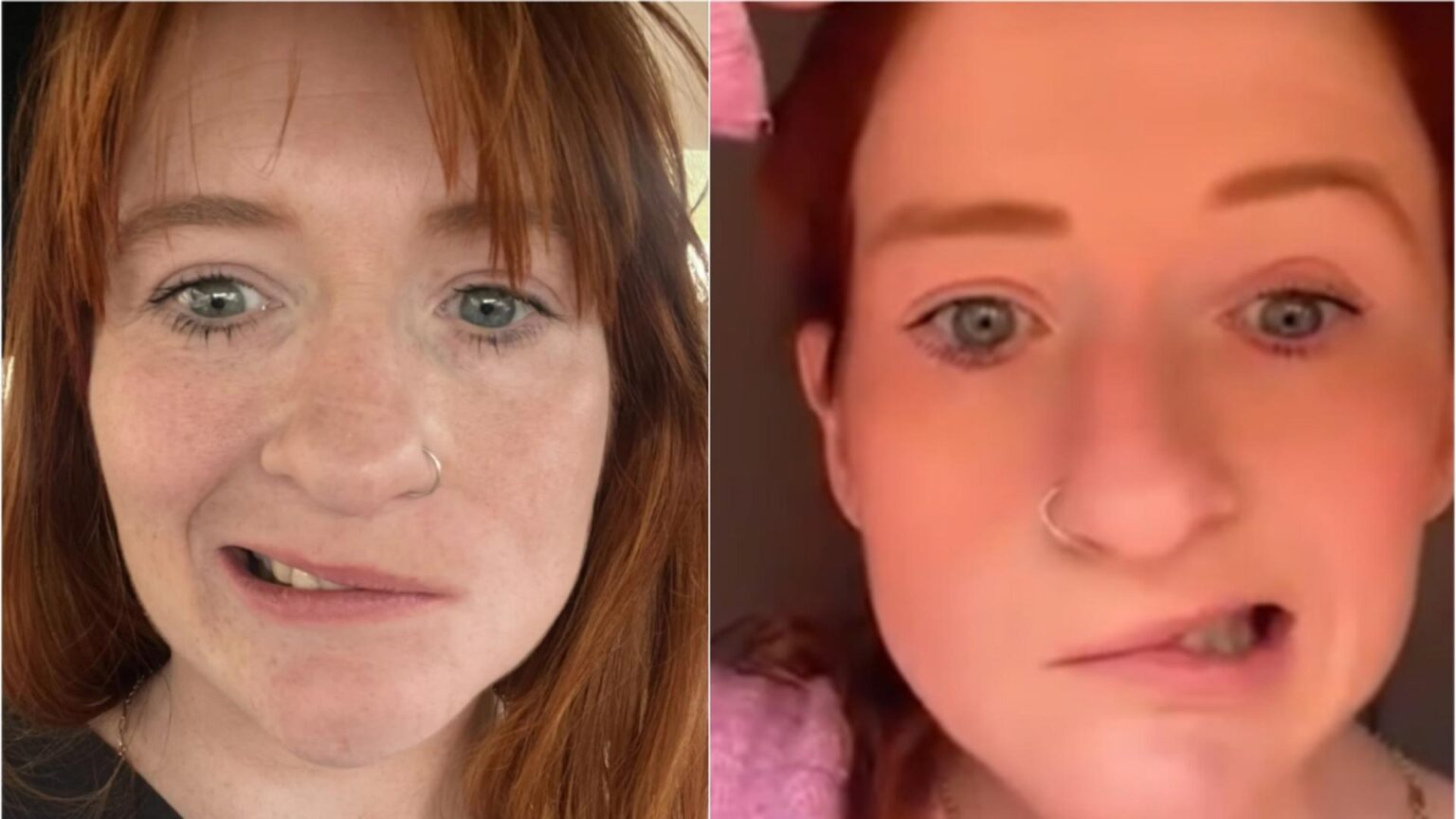 durerea unei tinere mame i a paralizat jumatate de fata dupa ce a consumat o bautura banala viata mea s a schimbat complet 68e814e193707