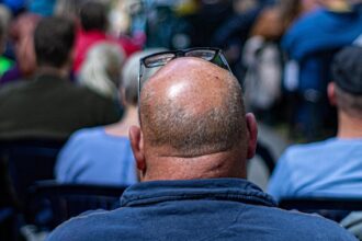 tragedie in turcia un barbat venit pentru implant de par si tratament dentar a murit la scurt timp dupa proceduri 691799fd1b847