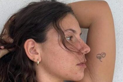 tanara care si a pierdut vederea la ochiul drept din cauza unui parazit sunt in intuneric de doua saptamani 695ba5d6b2bd2